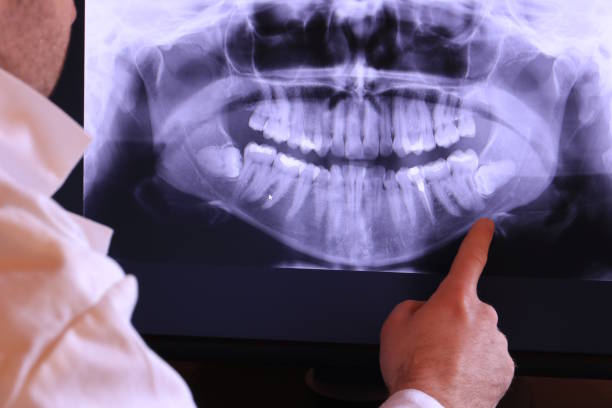 Best Emergency Wisdom Teeth Removal in Hopkinsville, KY