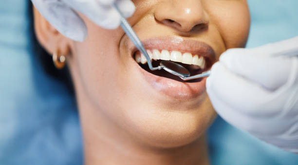 Best Emergency Dental Surgery in Hopkinsville, KY